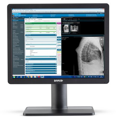 Betrachtungsmonitor Barco Eonis MDRC 2324 BW Plus