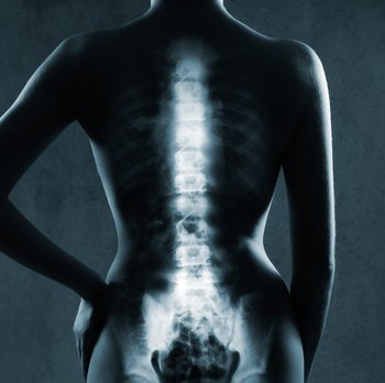 Strahlenschutz Röntgen Wirbelsäule