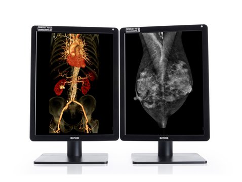 Befundungsmonitor Röntgen NIO Color 5MP Dual Head