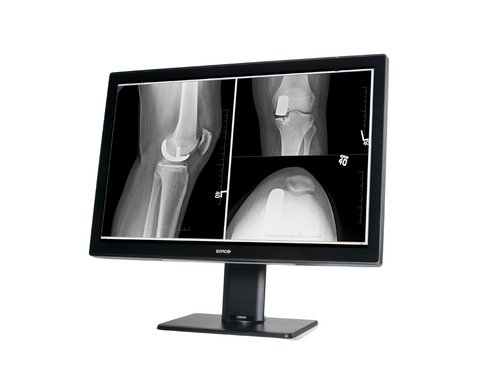  Radiologischer Monitor Coronis Fusion 4MP