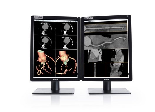 Radiologie Monitor Barco Uniti MDnC 12130 Mammobefundung BW Plus
