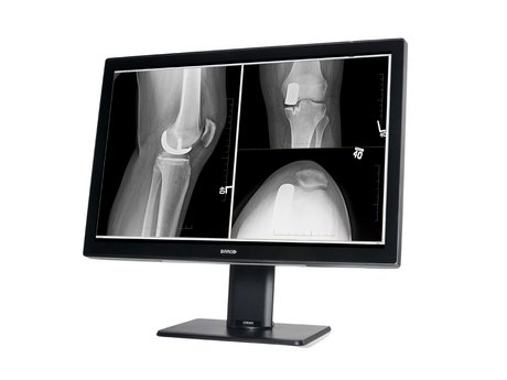 Befundungsmonitor Radiologie Barco Coronis 4 MP Color BW Plus