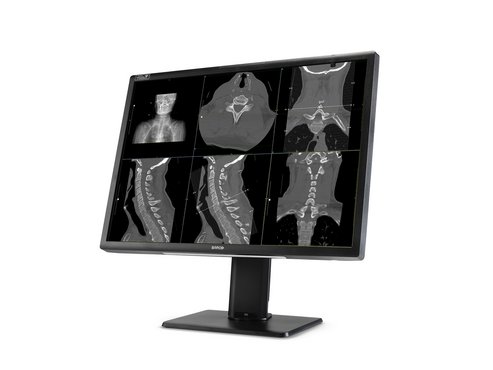Radiologischer Monitor Modell MDNC-12130 persp right transp01