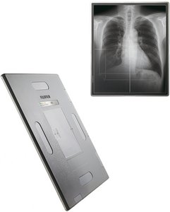 Röntgendetektor und Röntgenbild