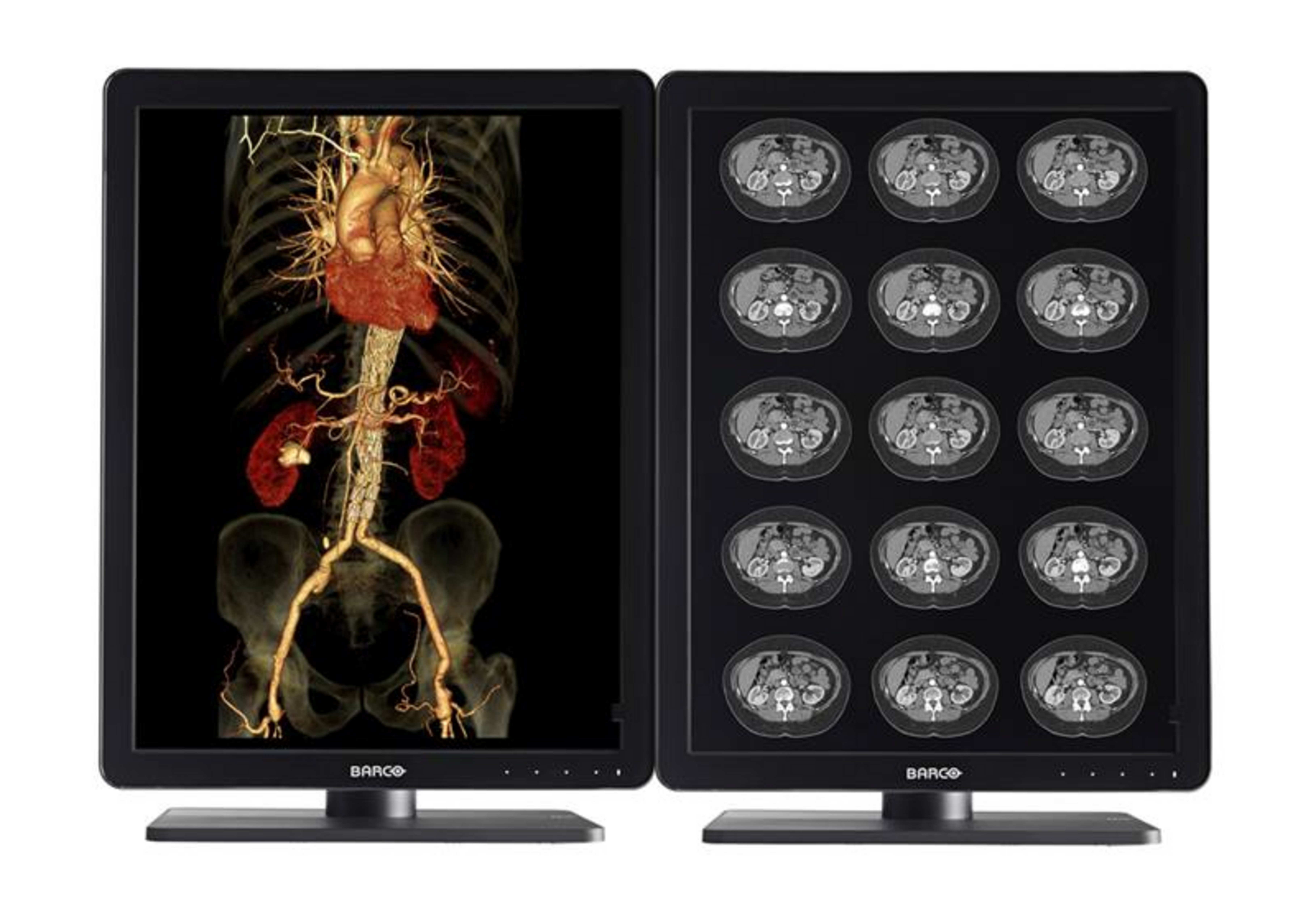 Radiologische Monitore und Zubehör BW Plus Röntgen