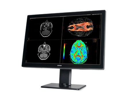 Befundungsmonitor Radiologie Barco Coronis 6 MP Color BW Plus